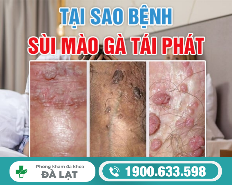 Hình ảnh minh họa